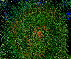 Deep in the Tall Grass ~ Philip Brent