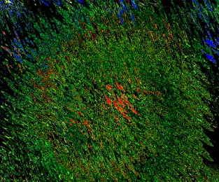 Deep in the Tall Grass ~ Philip Brent